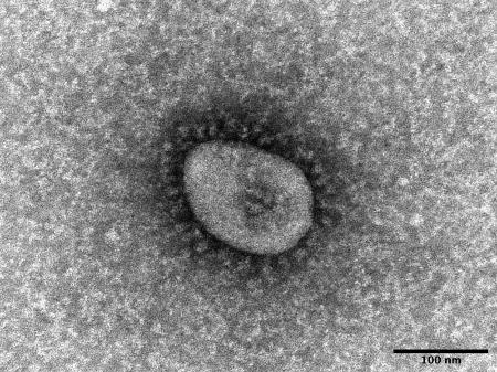 　新型コロナウイルス変異株「オミクロン株」の電子顕微鏡写真（国立感染症研究所提供）