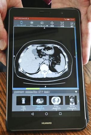　診断画像をスマートフォンでも受け取れるデジタル医療システム（画面の一部を画像加工しています）