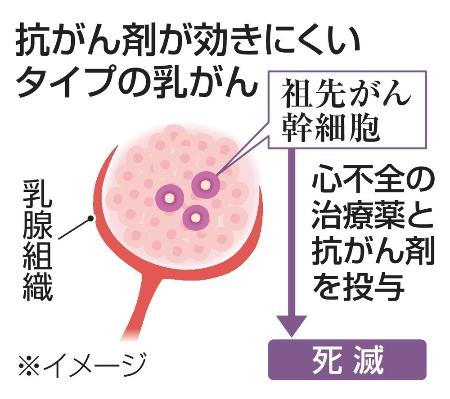 　抗がん剤が効きにくいタイプの乳がん