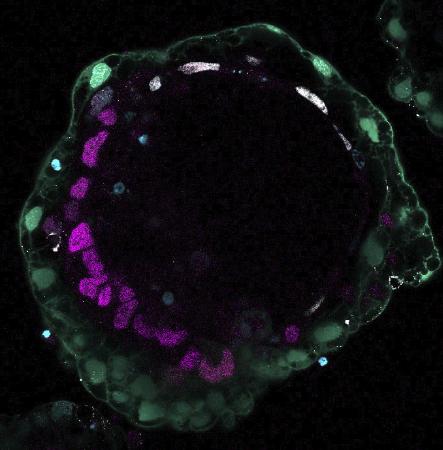 　ｉＰＳ細胞などから作製した培養９日目の人の胚モデルの顕微鏡写真（京都大提供）