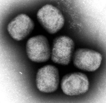 　エムポックスウイルスの電子顕微鏡写真（国立感染症研究所提供）