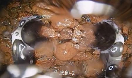 　東京電力が福島第１原発２号機の原子炉格納容器底部を撮影した動画の一部。中央に写っているのがデブリとみられる堆積物