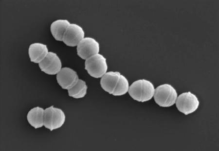 　劇症型溶血性レンサ球菌感染症の主な原因となる「Ａ群溶血性レンサ球菌」（国立感染症研究所提供）