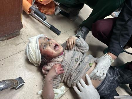　イスラエル軍による攻撃があったガザ地区中部デールバラハで、負傷して病院に運ばれ治療を受ける子ども＝２０日（ゲッティ＝共同）