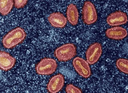 　感染細胞内のエムポックスウイルス（赤く着色）の電子顕微鏡写真（米国立アレルギー感染症研究所提供・共同）