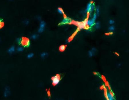 　マウスの脳にある血管の細胞に蓄積したタンパク質（赤色）（大阪大ウイルス学・木村志保子氏提供）
