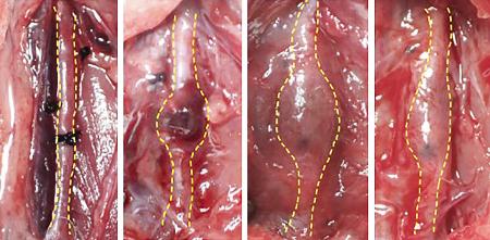 　ラットの血管（点線で囲まれた部分）にできた大動脈瘤がトリカプリンの投与で縮小したことを示す画像。（左から）大動脈瘤を作る手術をし、７日目にトリカプリンの投与を開始、１４日目のこぶ状の大動脈瘤が、２１日目には縮小した（近畿大提供）