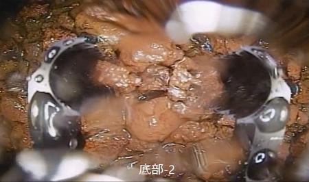 　福島第１原発２号機の原子炉格納容器底部を撮影した動画の一部。デブリとみられる堆積物が写っている