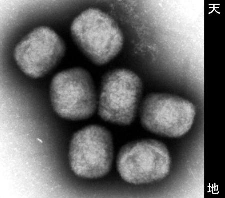 　エムポックスウイルスの電子顕微鏡写真（国立感染症研究所提供）