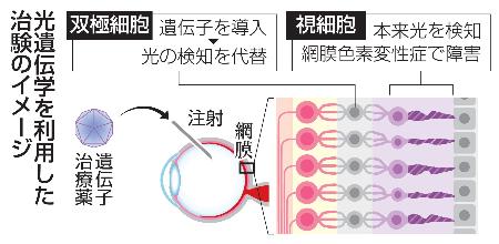 　光遺伝学を利用した治験のイメージ