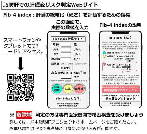 肝硬変のリスクを判定できるウェブサイトを紹介する資料（田中靖人教授提供）