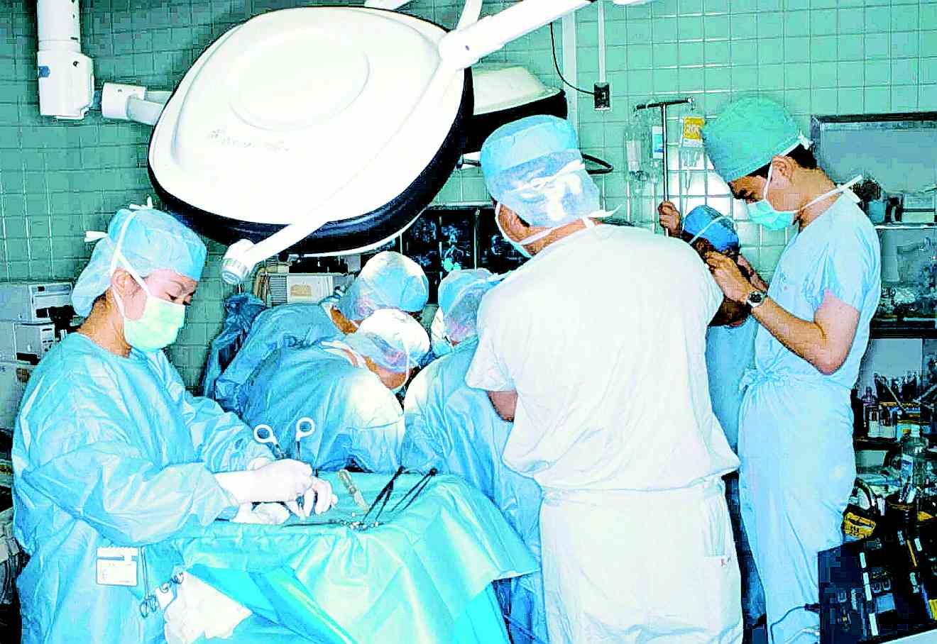 ドナーから肝臓の一部摘出手術をする熊本大の移植チーム（ドミノ移植時）＝2000年12月、熊本大病院
