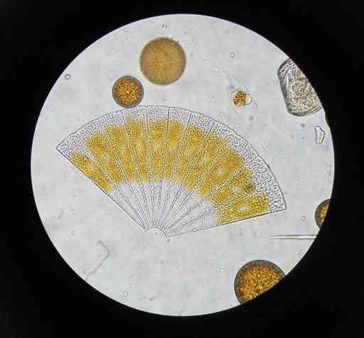 植物プランクトンを代表する珪藻類。２０１５年３月苓北町富岡沖で採集したものを顕微鏡下（４００倍）で撮影